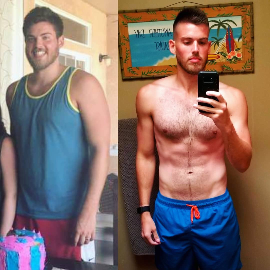 before-after